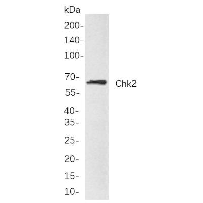 Western blot analysis of lysates from MDA-MB-231 cells, using Chk2 Rabbit mAb. The HRP-conjugated Goat anti-Rabbit IgG antibody (WS0002,) was used to detect the antibody.