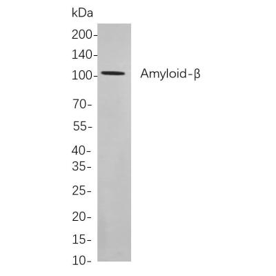 Western blot analysis of lysates from SH-SY5Y cells, using Amyloid-β Rabbit mAb. The HRP-conjugated Goat anti-Rabbit IgG antibody (WS0002,) was used to detect the antibody.