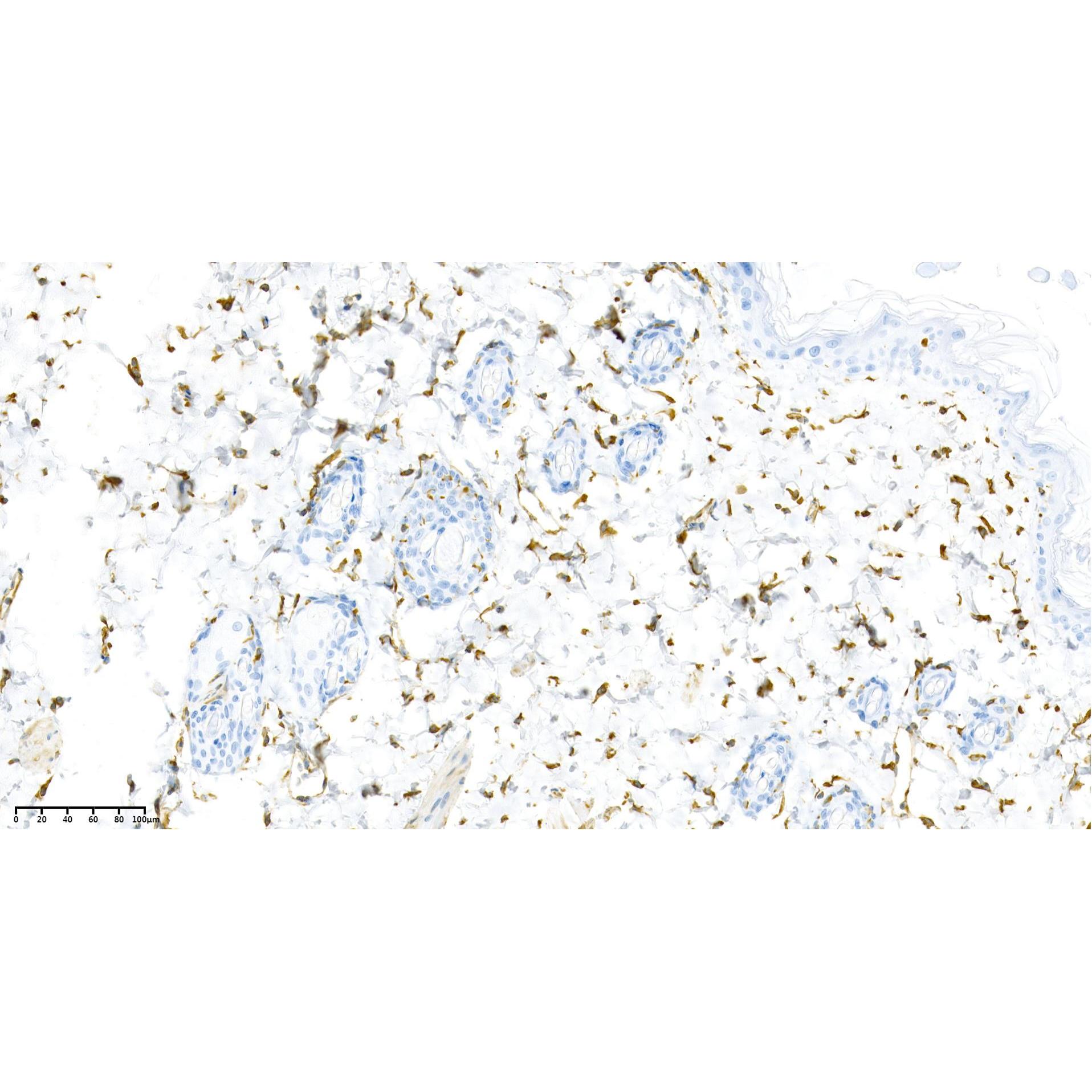 WR4297 Rat skin Rat skin