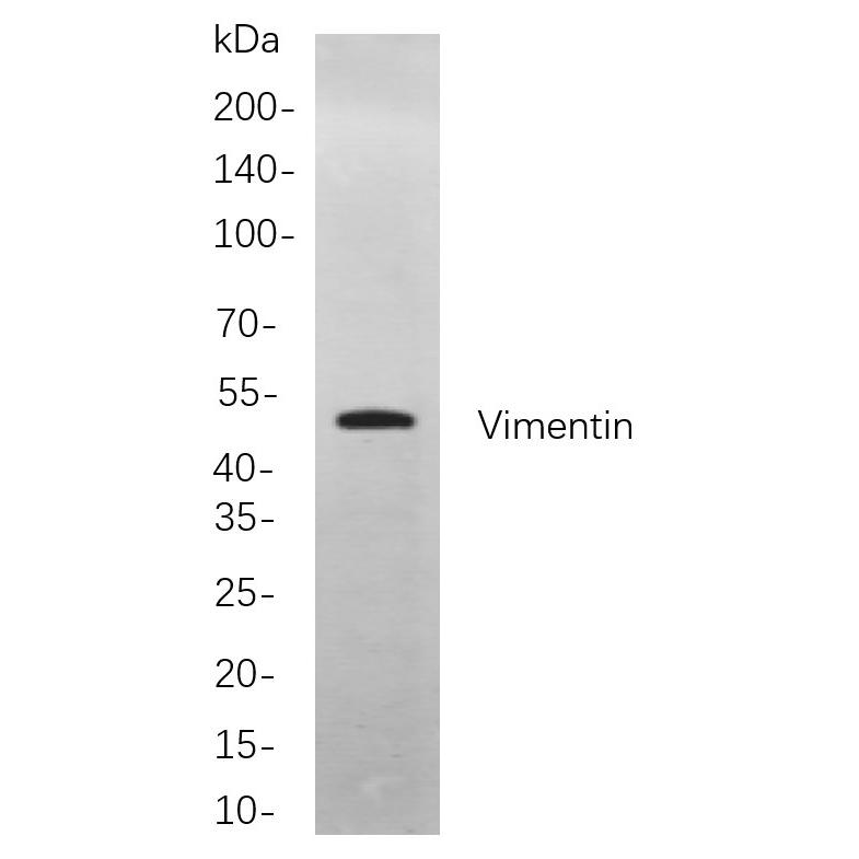 WR4297 Western blot analysis of lysates from Hela cells, using Vimentin Rabbit mAb. The HRP-conjugated Goat anti-Rabbit IgG antibody (WS0002) was used to detect the antibody. Western blot analysis of lysates from Hela cells, using Vimentin Rabbit mAb. The HRP-conjugated Goat anti-Rabbit IgG antibody (RS0002,immunoway) was used to detect the antibody.
