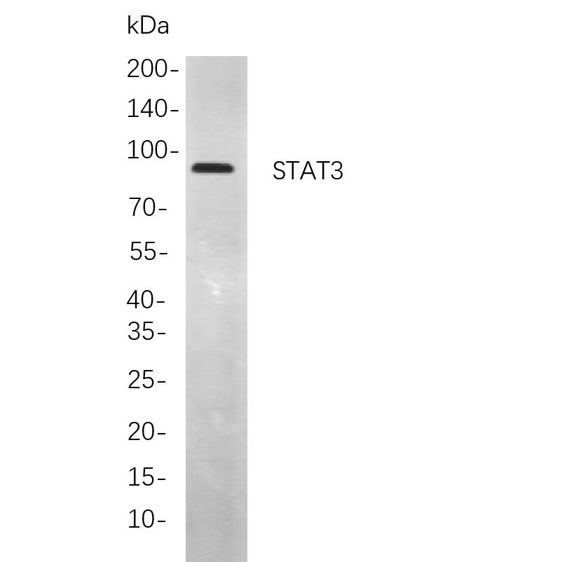 WR4298 Western blot analysis of lysates from MCF7 cells, using STAT3 Rabbit mAb. The HRP-conjugated Goat anti-Rabbit IgG antibody (WS0002) was used to detect the antibody. Western blot analysis of lysates from MCF7 cells, using STAT3 Rabbit mAb. The HRP-conjugated Goat anti-Rabbit IgG antibody (RS0002,immunoway) was used to detect the antibody.