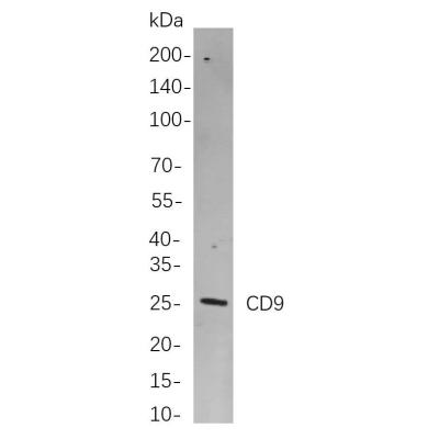 Western blot analysis of lysates from Rat womb cells, using CD9 Rabbit mAb. The HRP-conjugated Goat anti-Rabbit IgG antibody (WS0002, ) was used to detect the antibody.