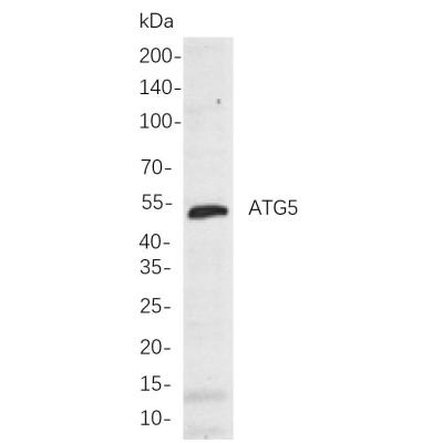 A549 whole cell lysates were separated by 10% SDS-PAGE, and the membrane was blotted with primary antibody(1:1000). The HRP-conjugated Goat anti-Rabbit IgG(H + L) antibody was used to detect the antibody.