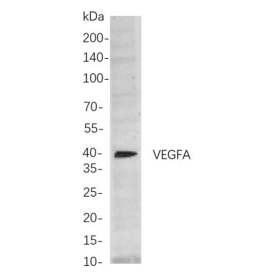 Western blot analysis of lysates from SH-SY5Y cells, using VEGFA Rabbit mAb. The HRP-conjugated Goat anti-Rabbit IgG antibody was used to detect the antibody.