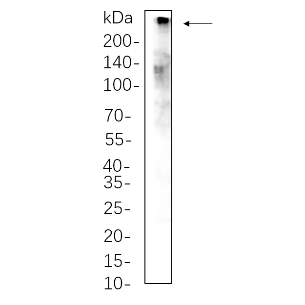 WR4321 Hela whole cell lysates were separated by 10% SDS-PAGE, and the membrane was blotted with primary antibody(1:1000). The HRP-conjugated Goat anti-Rabbit IgG(H + L) antibody was used to detect the antibody. Hela whole cell lysates were separated by 10% SDS-PAGE, and the membrane was blotted with primary antibody(1:1000). The HRP-conjugated Goat anti-Rabbit IgG(H + L) antibody was used to detect the antibody.