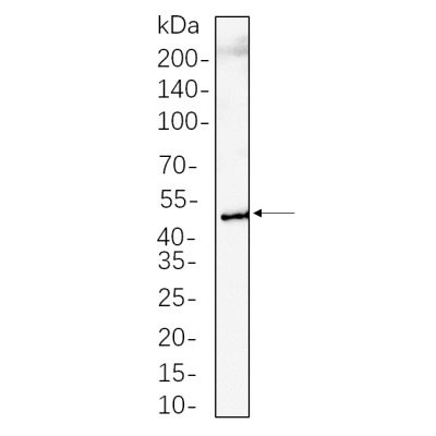 J774A.1 whole cell lysates were separated by 10% SDS-PAGE, and the membrane was blotted with primary antibody(1:1000). The HRP-conjugated Goat anti-Rabbit IgG(H + L) antibody was used to detect the antibody.