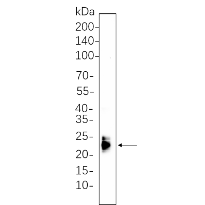 Mouse spleen whole cell lysates were separated by 10% SDS-PAGE, and the membrane was blotted with primary antibody(1:1000). The HRP-conjugated Goat anti-Rabbit IgG(H + L) antibody was used to detect the antibody.