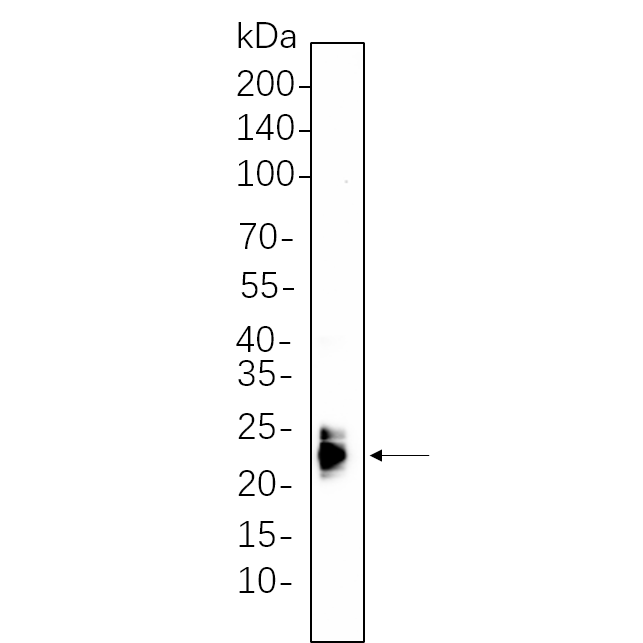 WR4325 Mouse spleen whole cell lysates were separated by 10% SDS-PAGE, and the membrane was blotted with primary antibody(1:1000). The HRP-conjugated Goat anti-Rabbit IgG(H + L) antibody was used to detect the antibody. Mouse spleen whole cell lysates were separated by 10% SDS-PAGE, and the membrane was blotted with primary antibody(1:1000). The HRP-conjugated Goat anti-Rabbit IgG(H + L) antibody was used to detect the antibody.