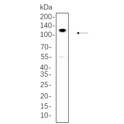 RT-4 whole cell lysates were separated by 10% SDS-PAGE, and the membrane was blotted with primary antibody(1:1000). The HRP-conjugated Goat anti-Rabbit IgG(H + L) antibody was used to detect the antibody.
