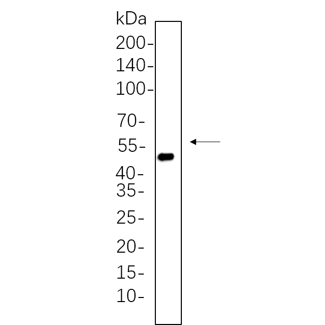 WR4329 HT-29 whole cell lysates were separated by 10% SDS-PAGE, and the membrane was blotted with primary antibody(1:1000). The HRP-conjugated Goat anti-Rabbit IgG(H + L) antibody was used to detect the antibody.HT-29 whole cell lysates were separated by 10% SDS-PAGE, and the membrane was blotted with primary antibody(1:1000). The HRP-conjugated Goat anti-Rabbit IgG(H + L) antibody was used to detect the antibody. HT-29 whole cell lysates were separated by 10% SDS-PAGE, and the membrane was blotted with primary antibody(1:1000). The HRP-conjugated Goat anti-Rabbit IgG(H + L) antibody was used to detect the antibody.