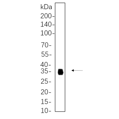 MES-SA cell lysates were separated by 4-20% SDS-PAGE, and the membrane was blotted with primary antibody 1:1000. The HRP-conjugated Goat anti-Rabbit IgG(H + L) antibody was used to detect the antibody.