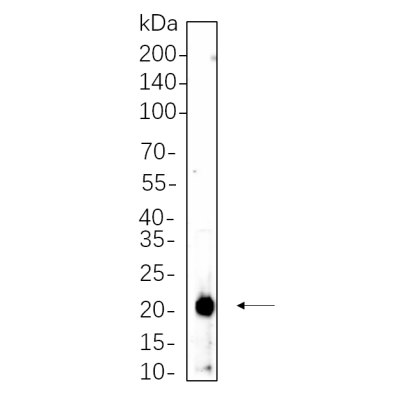 Rat womb cell lysates were separated by 4-20% SDS-PAGE, and the membrane was blotted with primary antibody 1:1000. The HRP-conjugated Goat anti-Rabbit IgG(H + L) antibody was used to detect the antibody.