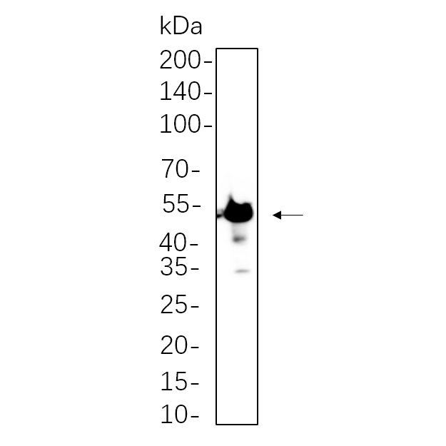 WR4338 SH-SY5Y whole cell lysates were separated by 10% SDS-PAGE, and the membrane was blotted with primary antibody(1:1000). The HRP-conjugated Goat anti-Rabbit IgG(H + L) antibody was used to detect the antibody. SH-SY5Y whole cell lysates were separated by 10% SDS-PAGE, and the membrane was blotted with primary antibody(1:1000). The HRP-conjugated Goat anti-Rabbit IgG(H + L) antibody was used to detect the antibody.