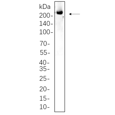 SH-SY5Y whole cell lysates were separated by 10% SDS-PAGE, and the membrane was blotted with primary antibody(1:1000). The HRP-conjugated Goat anti-Rabbit IgG(H + L) antibody was used to detect the antibody.