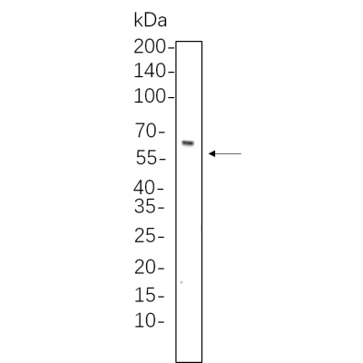 C6 whole cell lysates were separated by 10% SDS-PAGE, and the membrane was blotted with primary antibody(1:1000). The HRP-conjugated Goat anti-Rabbit IgG(H + L) antibody was used to detect the antibody.