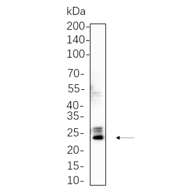 K562 cell lysates were separated by 4-20% SDS-PAGE, and the membrane was blotted with primary antibody 1:1000. The HRP-conjugated Goat anti-Rabbit IgG(H + L) antibody was used to detect the antibody.