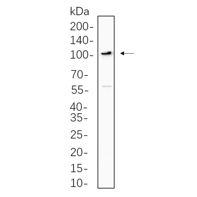 Hela cell lysates were separated by 4-20% SDS-PAGE, and the membrane was blotted with primary antibody 1:1000. The HRP-conjugated Goat anti-Rabbit IgG(H + L) antibody was used to detect the antibody.
