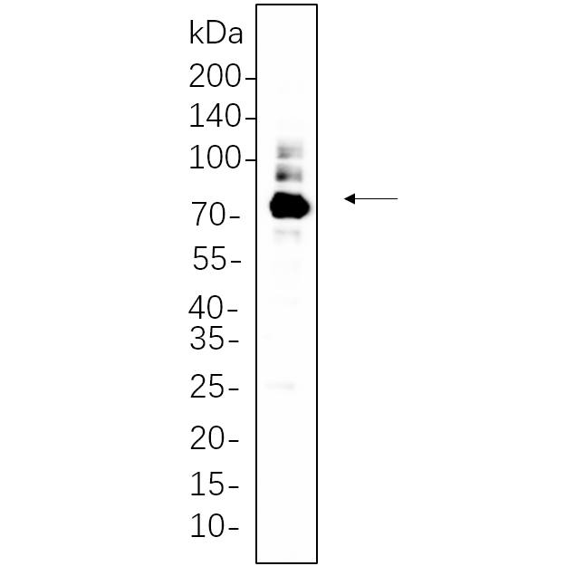 WR4349 huh-7 cell lysates were separated by 4-20% SDS-PAGE, and the membrane was blotted with primary antibody 1:1000. The HRP-conjugated Goat anti-Rabbit IgG(H + L) antibody was used to detect the antibody. huh-7 cell lysates were separated by 4-20% SDS-PAGE, and the membrane was blotted with primary antibody 1:1000. The HRP-conjugated Goat anti-Rabbit IgG(H + L) antibody was used to detect the antibody.