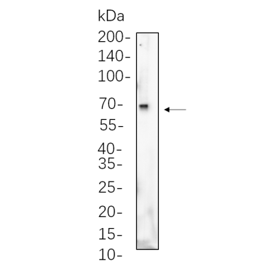 huh-7 cell lysates were separated by 4-20% SDS-PAGE, and the membrane was blotted with primary antibody 1:1000. The HRP-conjugated Goat anti-Rabbit IgG(H + L) antibody was used to detect the antibody.