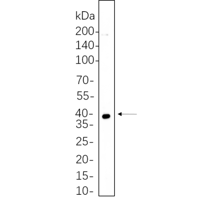 Jurkat cell lysates were separated by 4-20% SDS-PAGE, and the membrane was blotted with primary antibody 1:1000. The HRP-conjugated Goat anti-Rabbit IgG(H + L) antibody was used to detect the antibody.