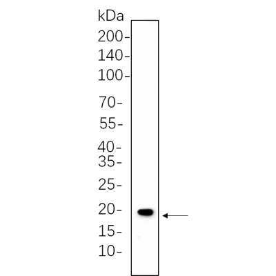 Hela whole cell lysates were separated by 10% SDS-PAGE, and the membrane was blotted with primary antibody(1:1000). The HRP-conjugated Goat anti-Rabbit IgG(H + L) antibody was used to detect the antibody.