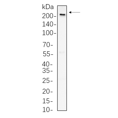 A549 whole cell lysates were separated by 10% SDS-PAGE, and the membrane was blotted with primary antibody(1:1000). The HRP-conjugated Goat anti-Rabbit IgG(H + L) antibody was used to detect the antibody.