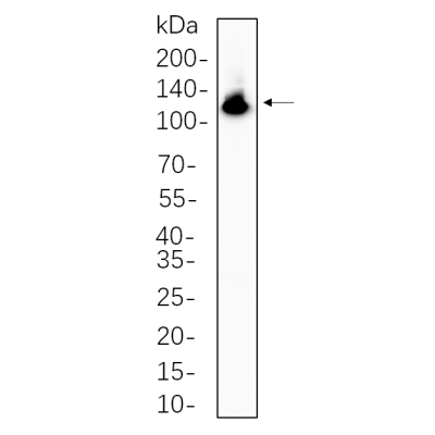 Hela cell lysates were separated by 4-20% SDS-PAGE, and the membrane was blotted with primary antibody 1:1000. The HRP-conjugated Goat anti-Rabbit IgG(H + L) antibody was used to detect the antibody.