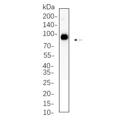 MRC-5 whole cell lysates were separated by 10% SDS-PAGE, and the membrane was blotted with primary antibody(1:1000). The HRP-conjugated Goat anti-Rabbit IgG(H + L) antibody was used to detect the antibody.
