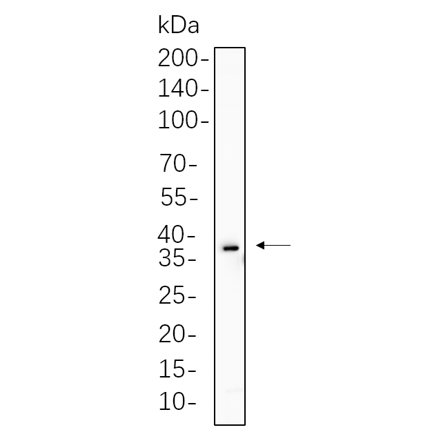 WR4365 RD cell lysates were separated by 4-20% SDS-PAGE, and the membrane was blotted with primary antibody 1:1000. The HRP-conjugated Goat anti-Rabbit IgG(H + L) antibody was used to detect the antibody. RD cell lysates were separated by 4-20% SDS-PAGE, and the membrane was blotted with primary antibody 1:1000. The HRP-conjugated Goat anti-Rabbit IgG(H + L) antibody was used to detect the antibody.