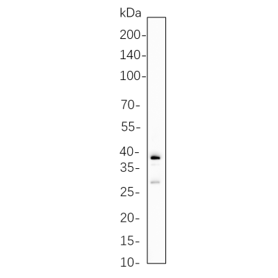 Karpas-299 cell lysates were separated by 4-20% SDS-PAGE, and the membrane was blotted with primary antibody 1:1000. The HRP-conjugated Goat anti-Rabbit IgG(H + L) antibody was used to detect the antibody.
