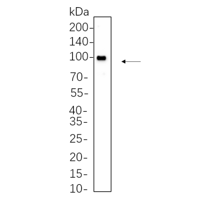 Hela whole cell lysates were separated by 10% SDS-PAGE, and the membrane was blotted with primary antibody(1:1000). The HRP-conjugated Goat anti-Rabbit IgG(H + L) antibody was used to detect the antibody.