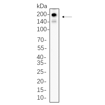 MG-63 whole cell lysates were separated by 10% SDS-PAGE, and the membrane was blotted with primary antibody(1:1000). The HRP-conjugated Goat anti-Rabbit IgG(H + L) antibody was used to detect the antibody.