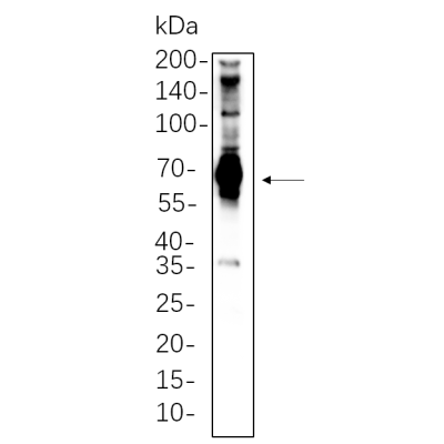 Hela whole cell lysates were separated by 10% SDS-PAGE, and the membrane was blotted with primary antibody(1:1000). The HRP-conjugated Goat anti-Rabbit IgG(H + L) antibody was used to detect the antibody.