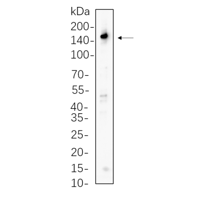 Rat brain cell lysates were separated by 4-20% SDS-PAGE, and the membrane was blotted with primary antibody 1:1000. The HRP-conjugated Goat anti-Rabbit IgG(H + L) antibody was used to detect the antibody.