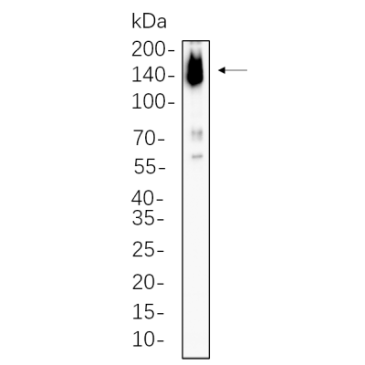SiHa cell lysates were separated by 4-20% SDS-PAGE, and the membrane was blotted with primary antibody 1:1000. The HRP-conjugated Goat anti-Rabbit IgG(H + L) antibody was used to detect the antibody.