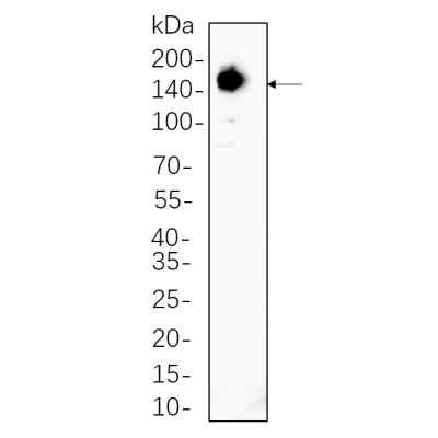 HEK293 cell lysates were separated by 4-20% SDS-PAGE, and the membrane was blotted with primary antibody 1:1000. The HRP-conjugated Goat anti-Rabbit IgG(H + L) antibody was used to detect the antibody.