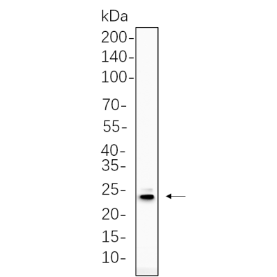 Hela cell lysates were separated by 4-20% SDS-PAGE, and the membrane was blotted with primary antibody 1:1000. The HRP-conjugated Goat anti-Rabbit IgG(H + L) antibody was used to detect the antibody.