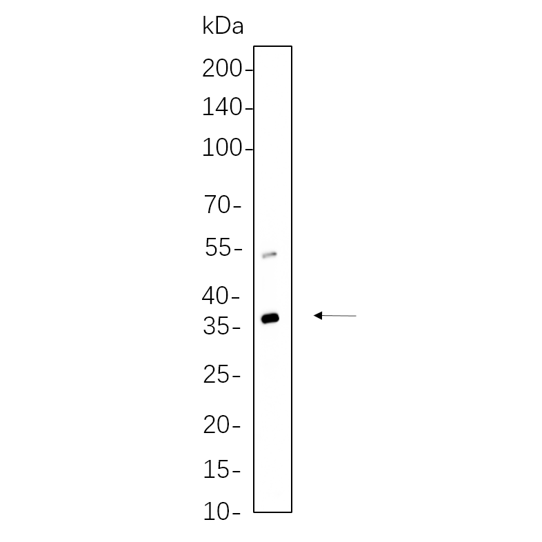 WR4389 3T3-L1 cell lysates were separated by 4-20% SDS-PAGE, and the membrane was blotted with primary antibody 1:1000. The HRP-conjugated Goat anti-Rabbit IgG(H + L) antibody was used to detect the antibody. 3T3-L1 cell lysates were separated by 4-20% SDS-PAGE, and the membrane was blotted with primary antibody 1:1000. The HRP-conjugated Goat anti-Rabbit IgG(H + L) antibody was used to detect the antibody.