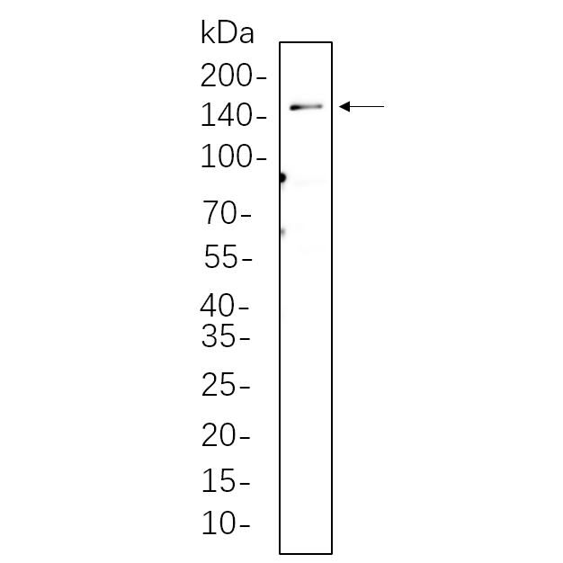 WR4390 C2C12 cell lysates were separated by 4-20% SDS-PAGE, and the membrane was blotted with primary antibody 1:1000. The HRP-conjugated Goat anti-Rabbit IgG(H + L) antibody was used to detect the antibody. C2C12 cell lysates were separated by 4-20% SDS-PAGE, and the membrane was blotted with primary antibody 1:1000. The HRP-conjugated Goat anti-Rabbit IgG(H + L) antibody was used to detect the antibody.
