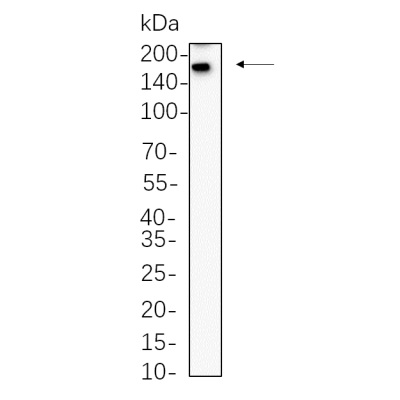 JAR whole cell lysates were separated by 10% SDS-PAGE, and the membrane was blotted with primary antibody(1:1000). The HRP-conjugated Goat anti-Rabbit IgG(H + L) antibody was used to detect the antibody.