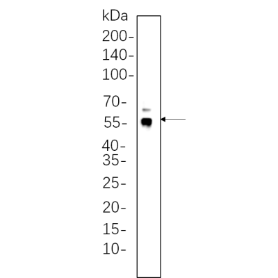 Mouse thymus whole cell lysates were separated by 10% SDS-PAGE, and the membrane was blotted with primary antibody(1:1000). The HRP-conjugated Goat anti-Rabbit IgG(H + L) antibody was used to detect the antibody.
