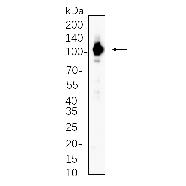 WR4404 Hela cell lysates were separated by 4-20% SDS-PAGE, and the membrane was blotted with primary antibody 1:1000. The HRP-conjugated Goat anti-Rabbit IgG(H + L) antibody was used to detect the antibody. Hela cell lysates were separated by 4-20% SDS-PAGE, and the membrane was blotted with primary antibody 1:1000. The HRP-conjugated Goat anti-Rabbit IgG(H + L) antibody was used to detect the antibody.