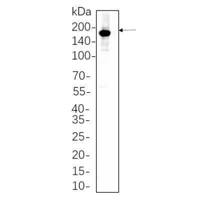 SK-BR-3 whole cell lysates were separated by 10% SDS-PAGE, and the membrane was blotted with primary antibody(1:1000). The HRP-conjugated Goat anti-Rabbit IgG(H + L) antibody was used to detect the antibody.