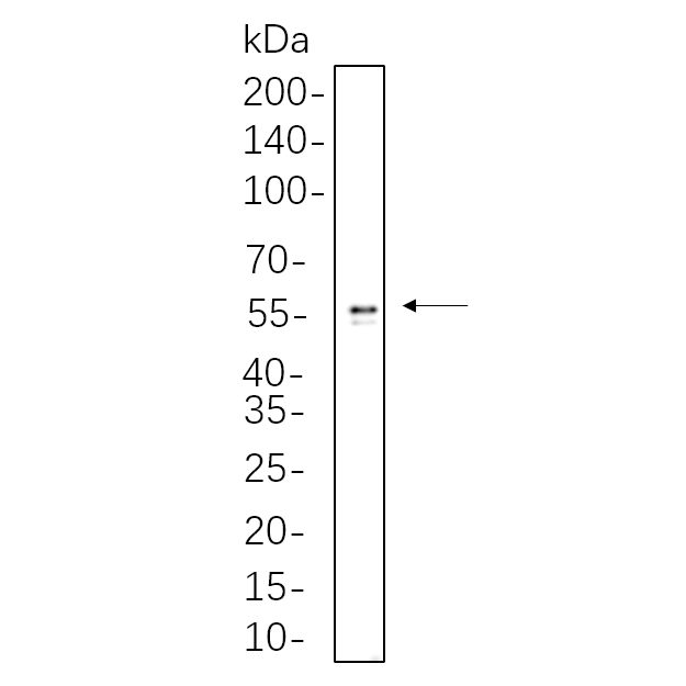 WR4410 HepG2 whole cell lysates were separated by 10% SDS-PAGE, and the membrane was blotted with primary antibody(1:1000). The HRP-conjugated Goat anti-Rabbit IgG(H + L) antibody was used to detect the antibody. HepG2 whole cell lysates were separated by 10% SDS-PAGE, and the membrane was blotted with primary antibody(1:1000). The HRP-conjugated Goat anti-Rabbit IgG(H + L) antibody was used to detect the antibody.