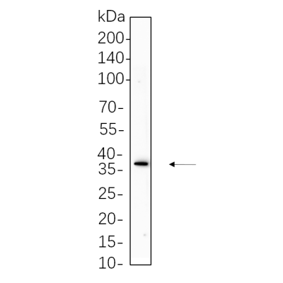 Mouse brain cell lysates were separated by 4-20% SDS-PAGE, and the membrane was blotted with primary antibody 1:1000. The HRP-conjugated Goat anti-Rabbit IgG(H + L) antibody was used to detect the antibody.