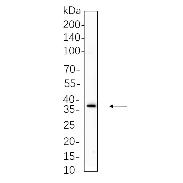 WR4419 Mouse brain cell lysates were separated by 4-20% SDS-PAGE, and the membrane was blotted with primary antibody 1:1000. The HRP-conjugated Goat anti-Rabbit IgG(H + L) antibody was used to detect the antibody. Mouse brain cell lysates were separated by 4-20% SDS-PAGE, and the membrane was blotted with primary antibody 1:1000. The HRP-conjugated Goat anti-Rabbit IgG(H + L) antibody was used to detect the antibody.