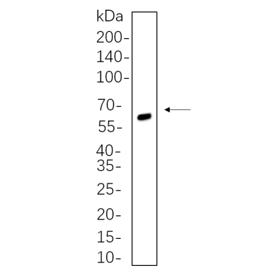 C6 whole cell lysates were separated by 10% SDS-PAGE, and the membrane was blotted with primary antibody(1:1000). The HRP-conjugated Goat anti-Rabbit IgG(H + L) antibody was used to detect the antibody.