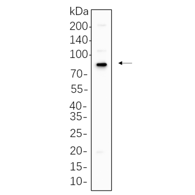 Mouse skin cell lysates were separated by 4-20% SDS-PAGE, and the membrane was blotted with primary antibody 1:1000. The HRP-conjugated Goat anti-Rabbit IgG(H + L) antibody was used to detect the antibody.