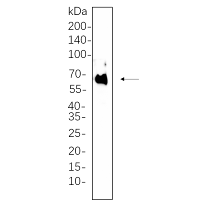 Hela whole cell lysates were separated by 10% SDS-PAGE, and the membrane was blotted with primary antibody(1:1000). The HRP-conjugated Goat anti-Rabbit IgG(H + L) antibody was used to detect the antibody.