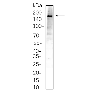 HepG2 whole cell lysates were separated by 10% SDS-PAGE, and the membrane was blotted with primary antibody(1:1000). The HRP-conjugated Goat anti-Rabbit IgG(H + L) antibody was used to detect the antibody.